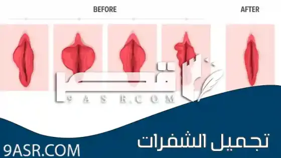 كل ما تريدين معرفته عن تجميل الشفرات مع الصور
