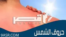 حروق الشمس