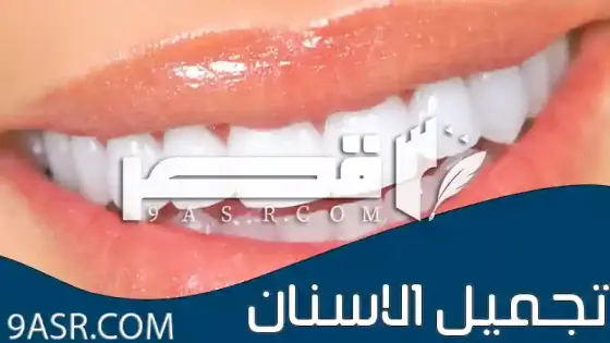 تجميل الاسنان: من التغيير إلى الابتسامة المثالية